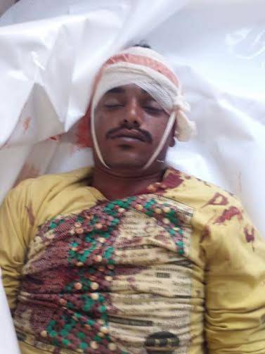 الضالع: مقتل قيادي في المقاومة ونجاة آخر في كمينين منفصلين بمنطقة مريس
