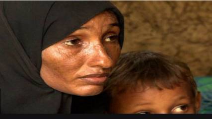 داخل "الحرب المنسية" في اليمن